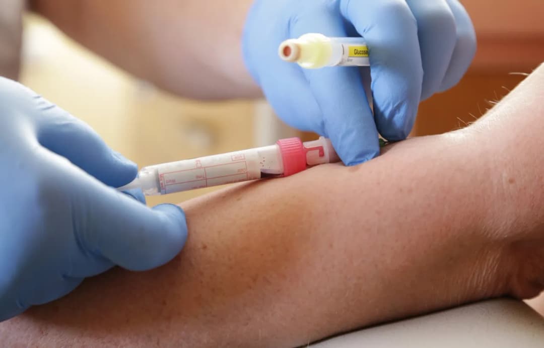 Co to jest lymph w badaniu krwi? Znaczenie i normy limfocytów