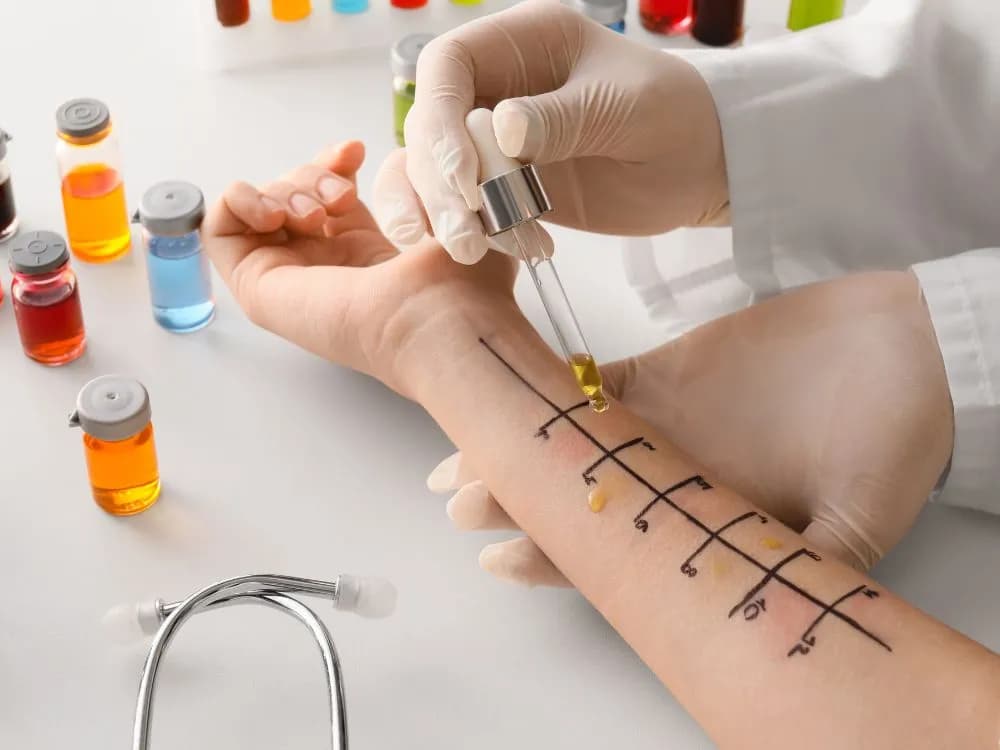 Gdzie zrobić testy alergiczne na leki i uniknąć niebezpieczeństw?
