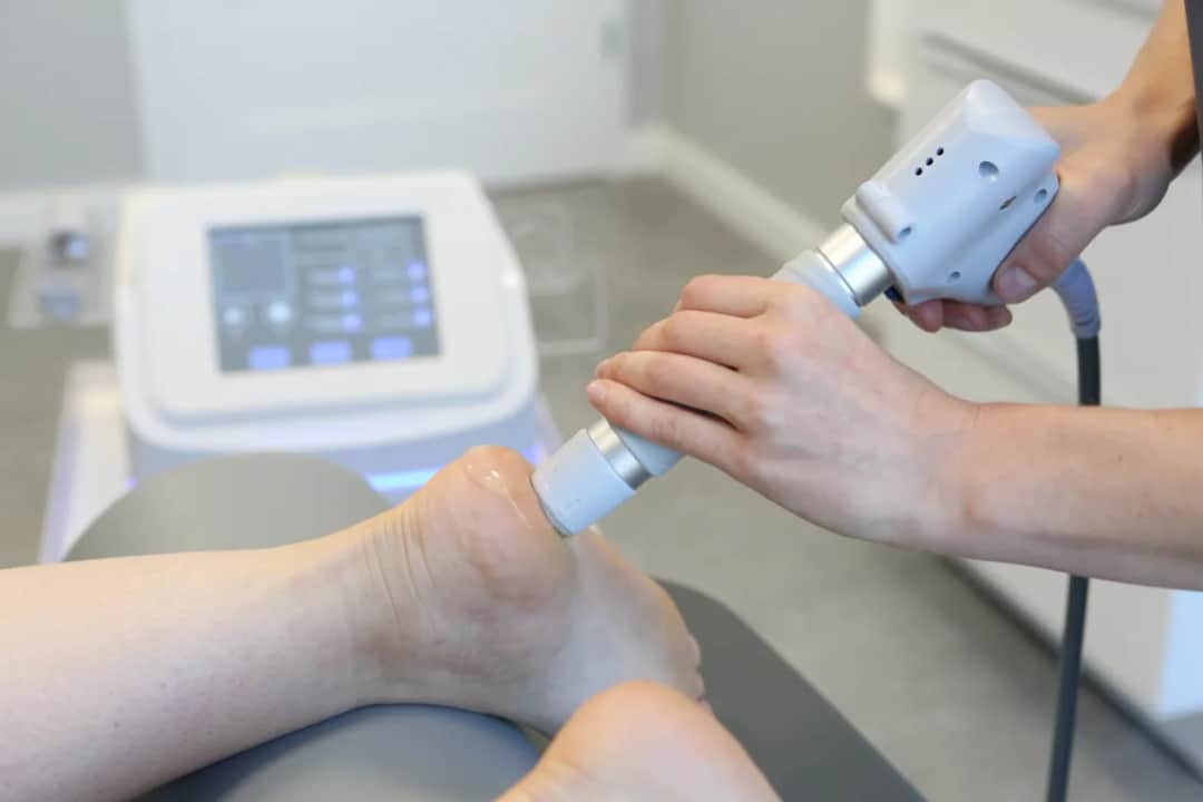 Zabieg na ostrogi piętowe falą uderzeniową - szybka ulga w bólu